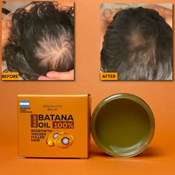 100% Pure Batana Oil Butter For Hair Regrowth